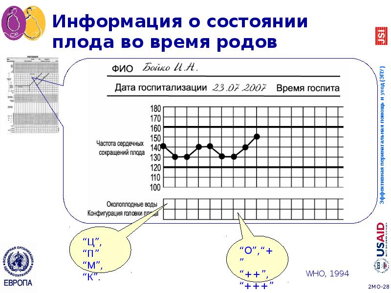 Информация о состоянии плода во время родов Информация о состоянии плода во время родов