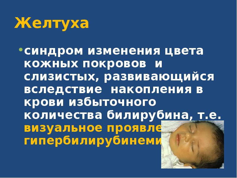 Гемолитическая желтуха новорожденных. Кератиновая желтуха у ребенка. Симптомы желтухи у новорожденных. Каротиновая желтуха у детей питание. Ложная каротиновая желтуха.