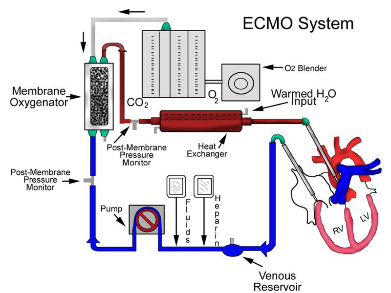 Схема системы экстракорпорального кровообращения