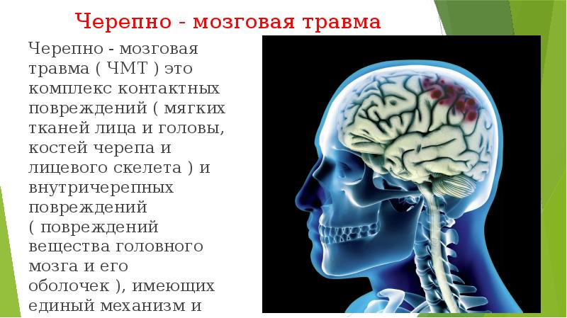 Сотрясение головного мозга презентация