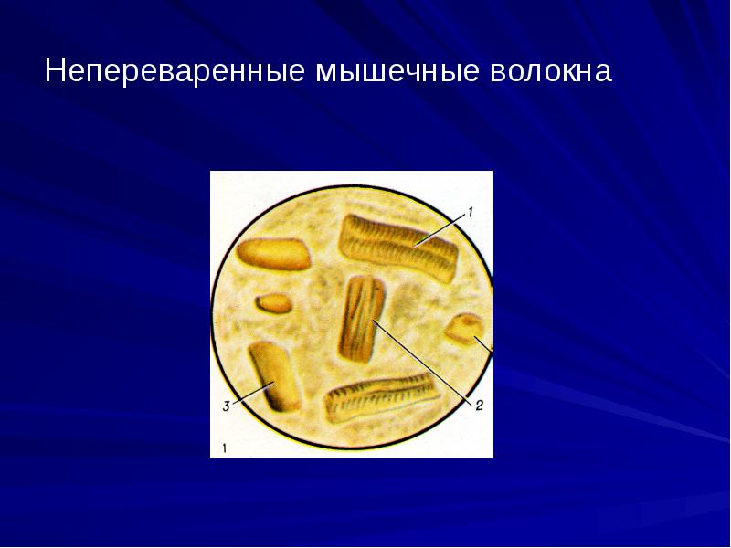 Непереваренные остатки пищи. Микроскопия кала мышечные волокна. Переваримые мышечные волокна в Кале. Непереваренные мышечные волокна в Кале. Мышечные волокна в Кале микроскопия.