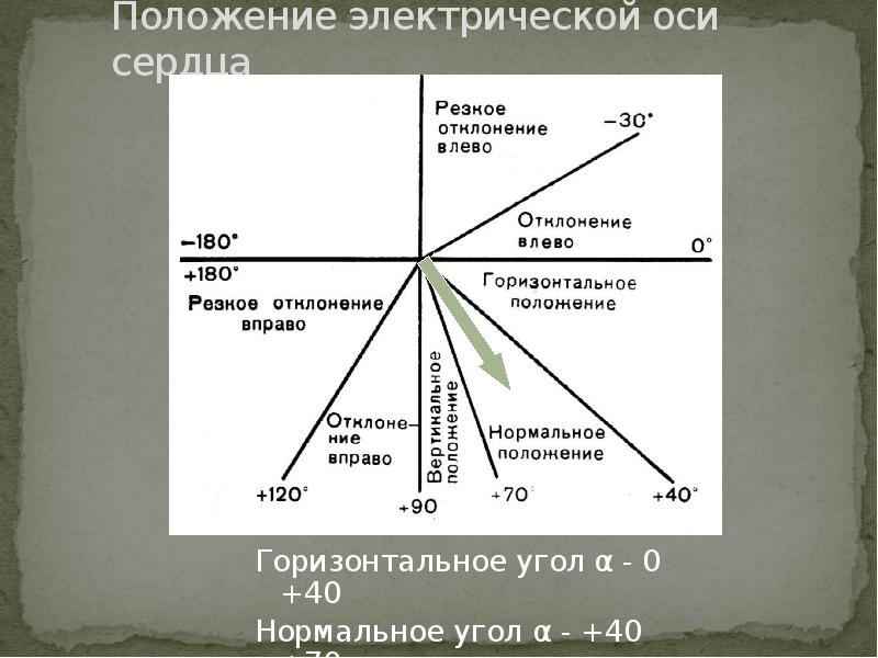 Вертикальная эос