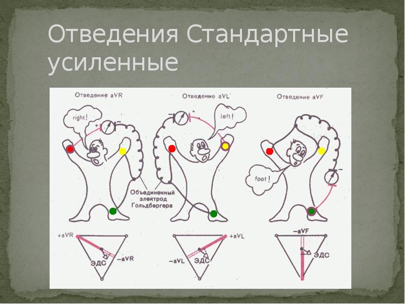 12 отведений экг схема