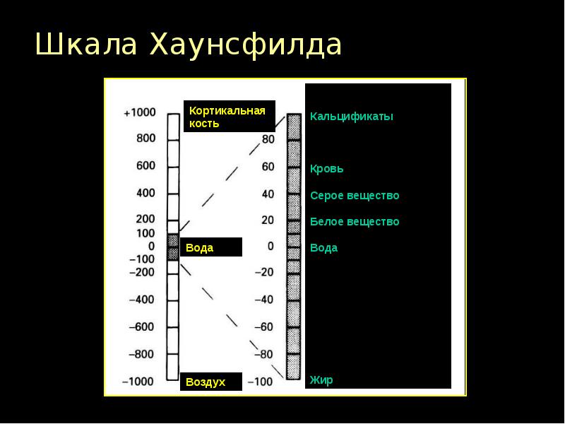 Шкала хаунсфилда презентация