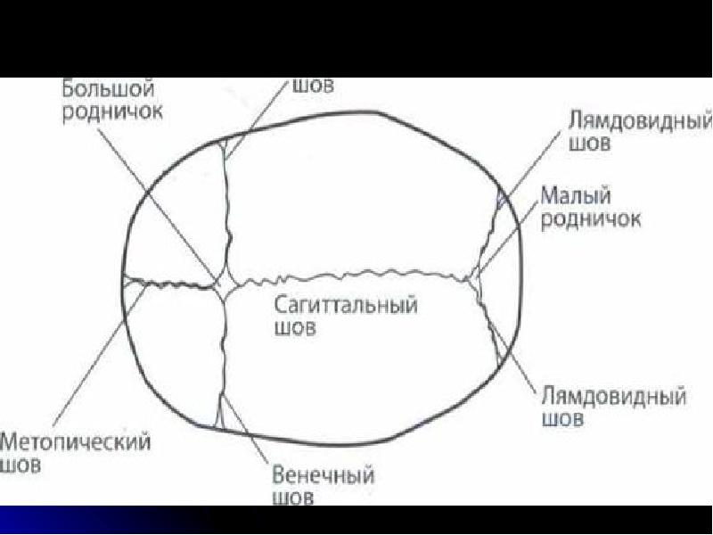 Стреловидный шов фото