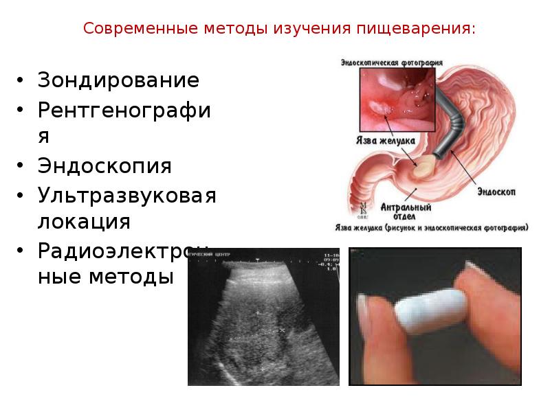 Методы изучения органов пищеварения биология. Ультразвуковой метод изучения процессов пищеварения у человека. Методика обследования пищеварительной системы. Рентгенографический метод изучения процессов пищеварения. Современные методы исследования пищеварительной системы человека.