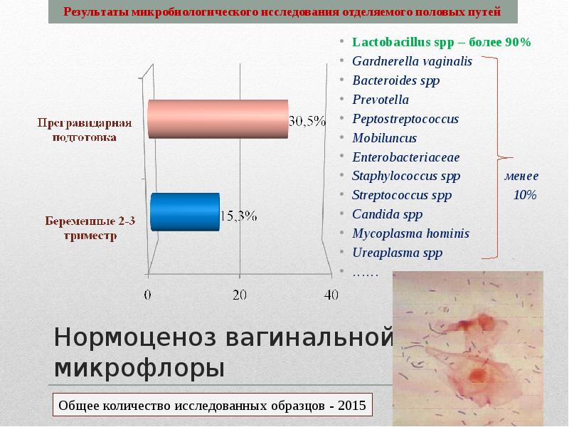Lactobacillus spp у мужчин
