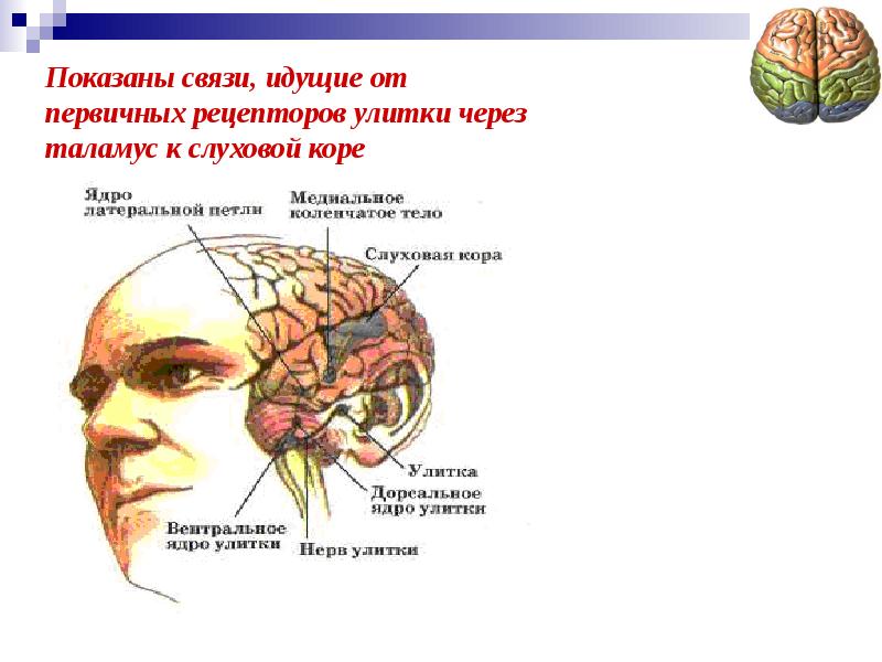 Презентация гностические слуховые расстройства