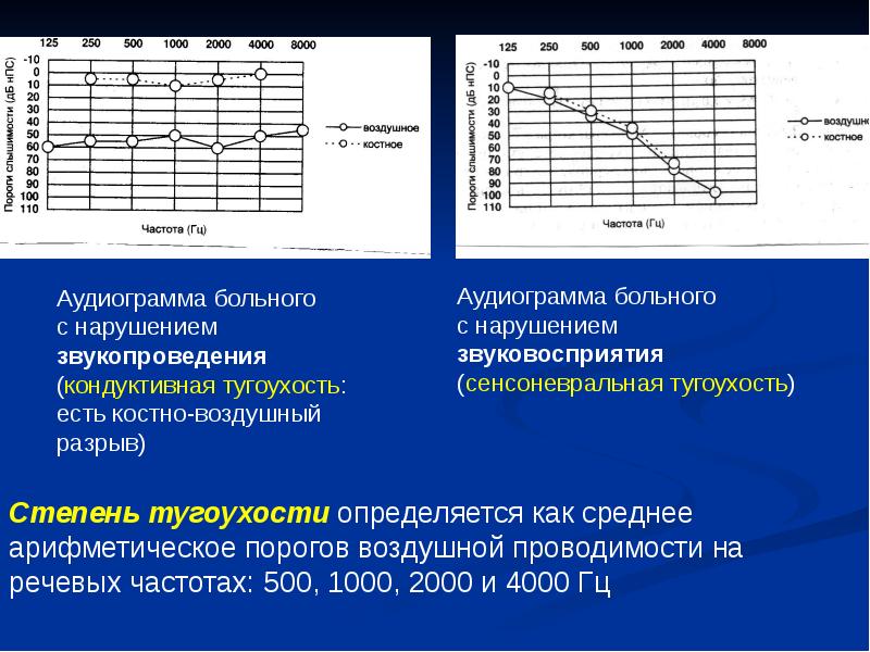 Методы исследования слухового анализатора презентация