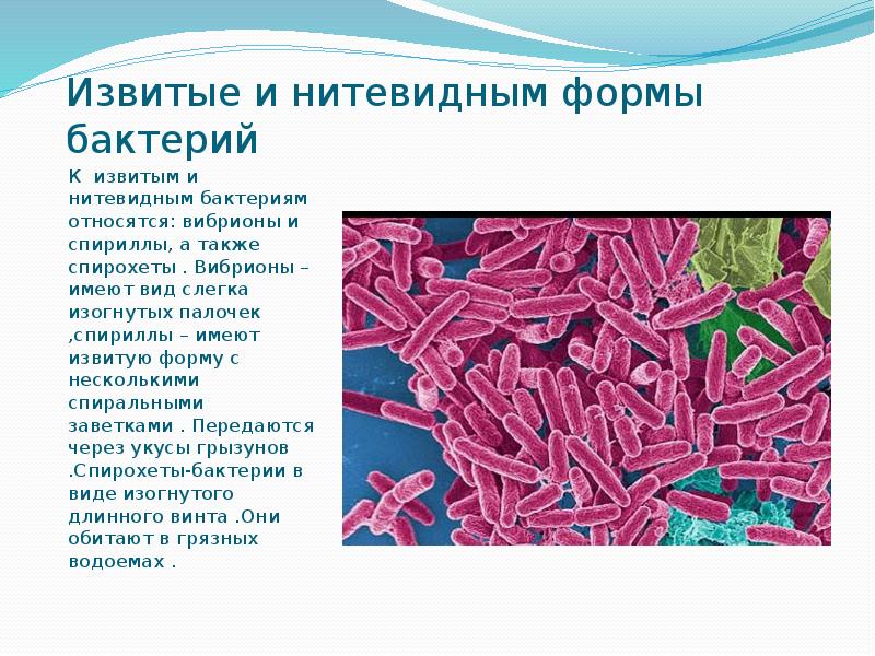 Нитевидные бактерии. Форма бактерии вибрионы. Нитевидные формы бактерий. К вибрионам относится. Вибрионы имеют форму.