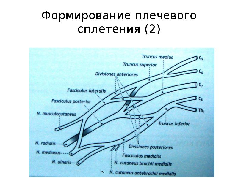 Плечевое сплетение схема