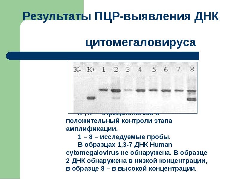 Отрицательный контрольный образец