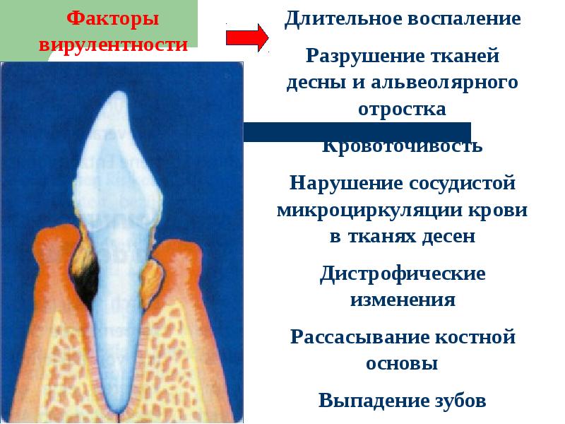 Генетические аспекты болезней пародонта презентация