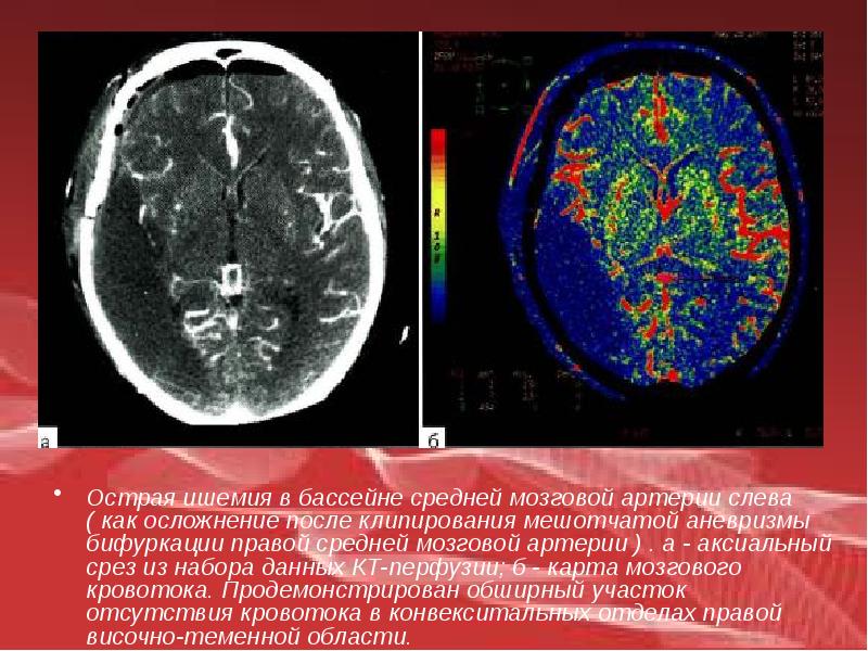 Лучевая диагностика в неврологии презентация