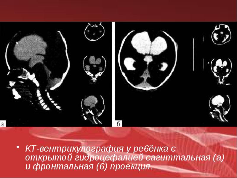 Лучевая диагностика в неврологии презентация