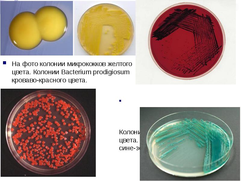 На фото колонии микрококков желтого цвета. Колонии Bacterium prodigiosum кроваво-красного цвета.
