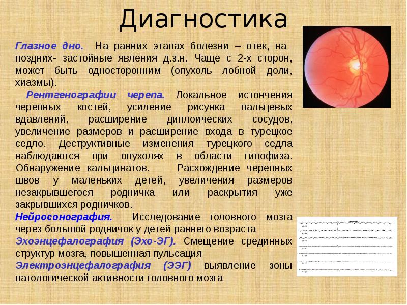 Опухоли головного и спинного мозга презентация