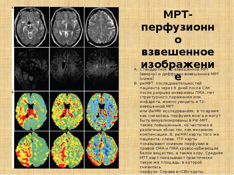 Как понять диффузно. Как понять диффузно