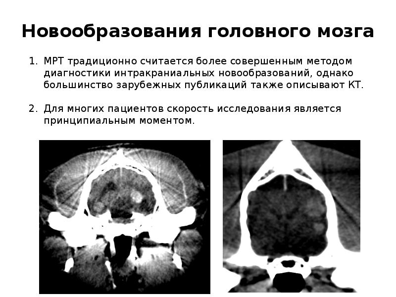 Кт в неврологии презентация