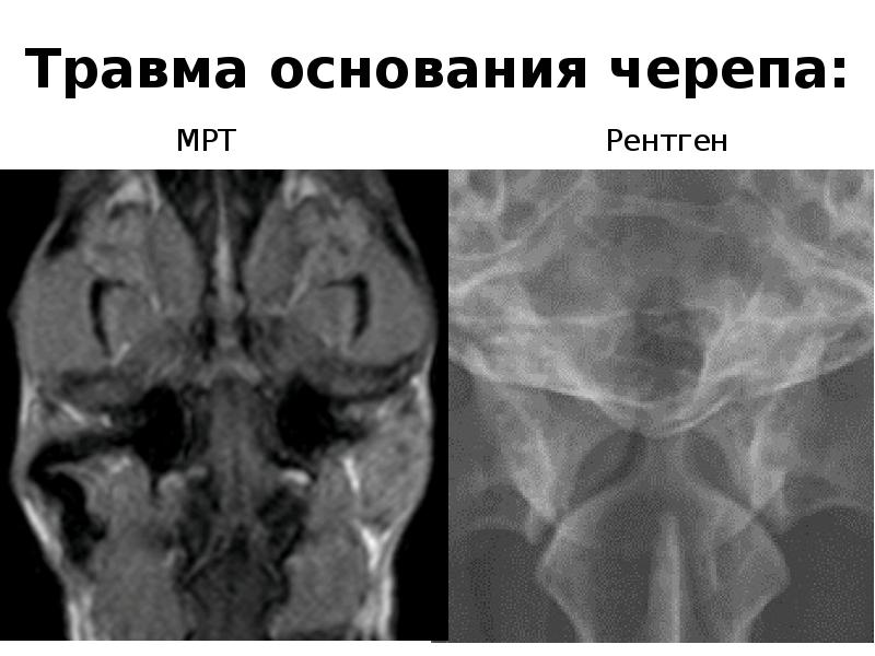 Кт в неврологии презентация