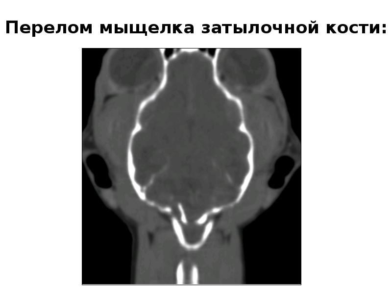 Кт в неврологии презентация