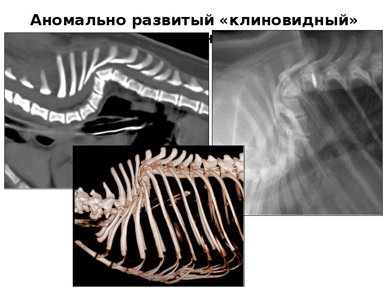 Кт в неврологии презентация