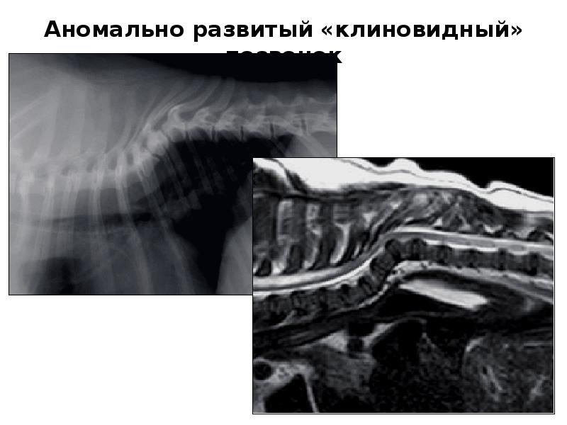 Кт в неврологии презентация