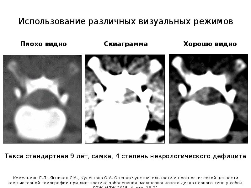 Кт в неврологии презентация