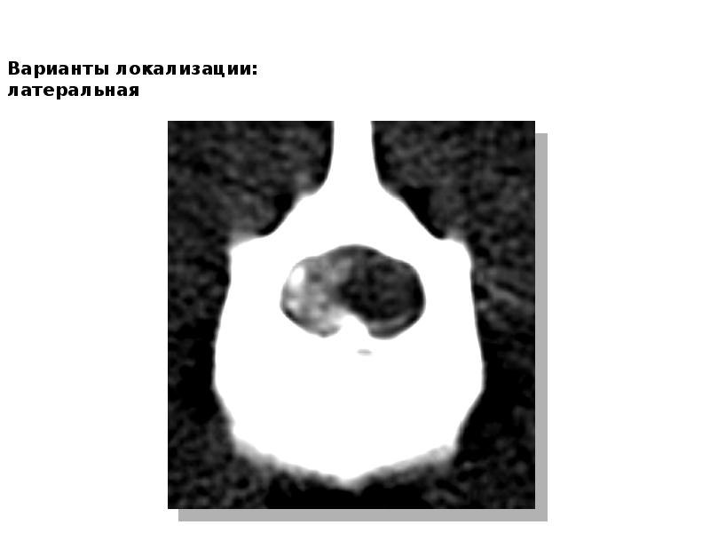 Кт в неврологии презентация