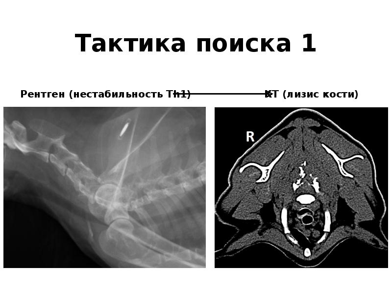 Кт в неврологии презентация