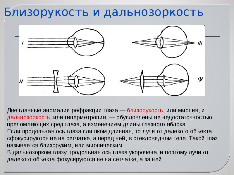 Картинки для проверки дальнозоркости