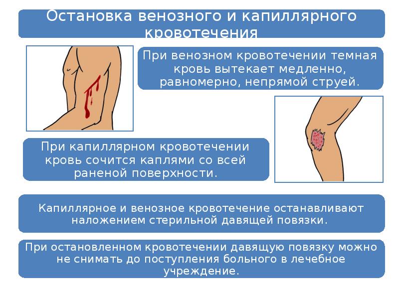 Кровотечение из заднего прохода карта вызова