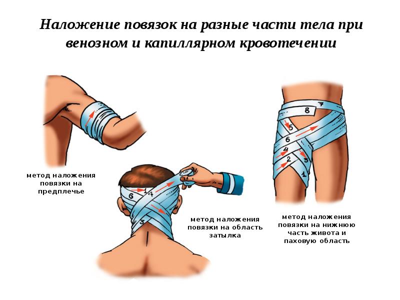 Первая помощь при ранениях картинки для презентации