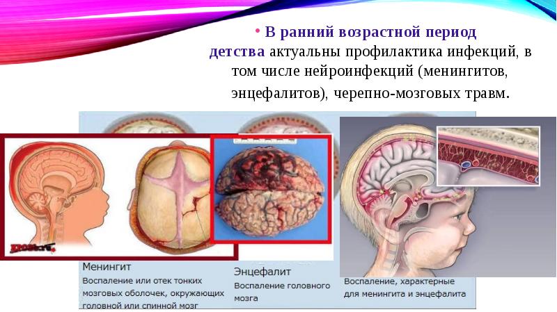 Профилактика эпилепсии презентация