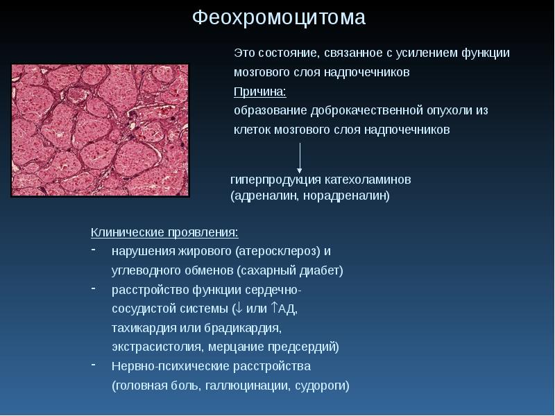 Опухоли презентация патология