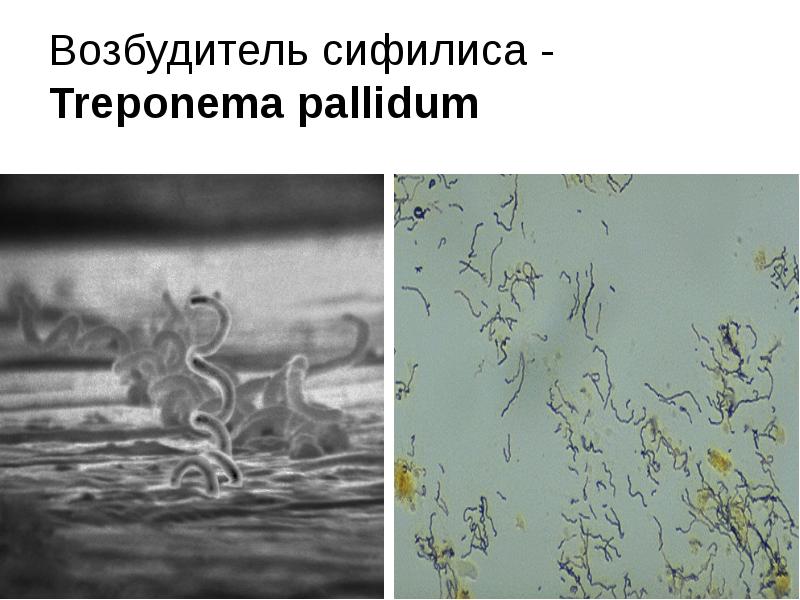 Трепонема микробиология презентация