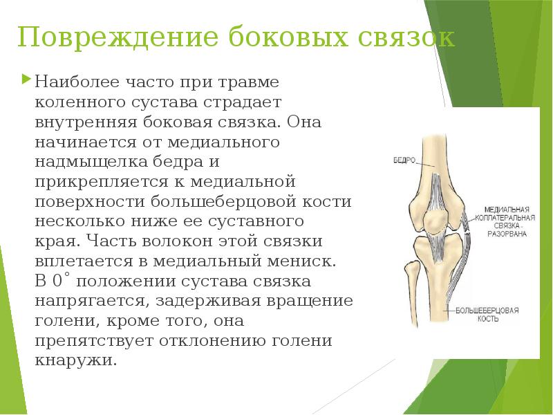 Боковая связка. Боковые связки коленного сустава. Внутренняя боковая связка коленного сустава. Разрыв боковой связки колена. Надмыщелок бедренной кости.