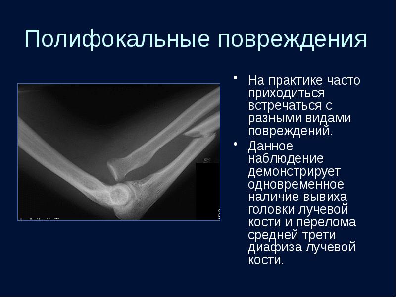 Лучевая диагностика костей презентация