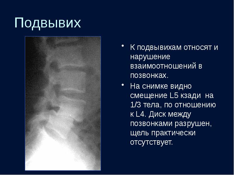 Подвывих шейного позвонка у ребенка карта вызова скорой медицинской