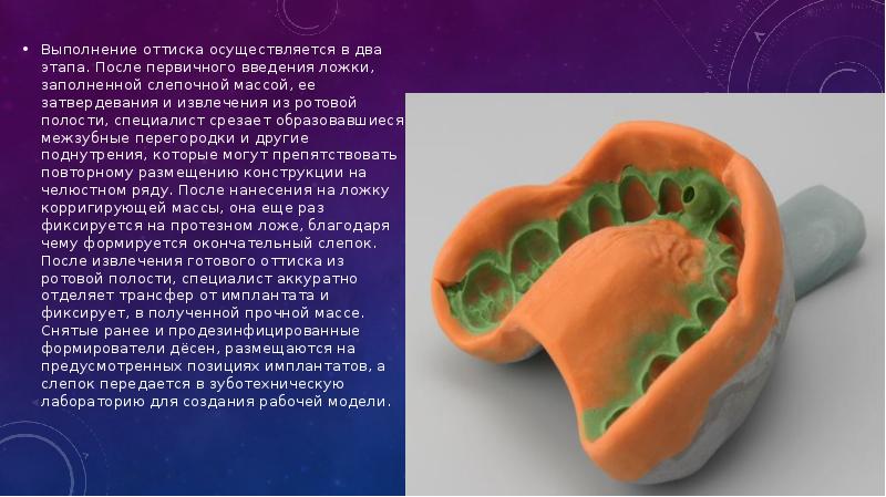 План обработки слепочной ложки