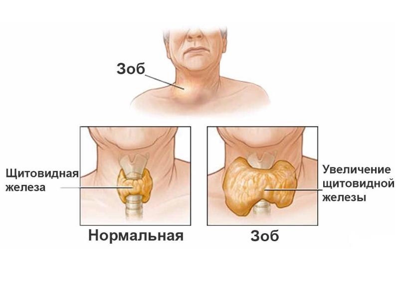 Где находится щитовидная железа у мужчин фото