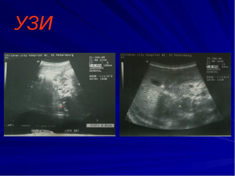 УЗИ УЗИ