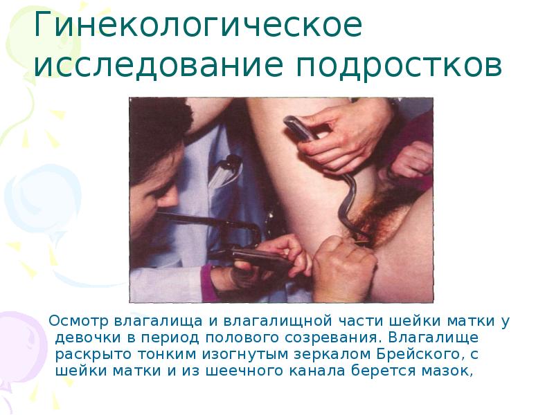 Санация шейки матки и влагалища в Международной клинике гемостаза