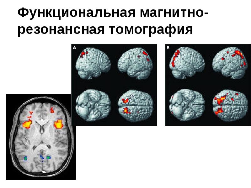 Метаболическая магнитно резонансная томограмма относится к функциональным изображениям