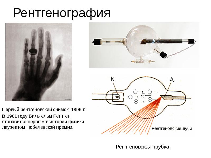 1 рентгеновский снимок. Рентгеновские эксперименты. Эксперимент рентгена. Первый рентгеновский снимок. 125 Лет первому рентгеновскому снимку.