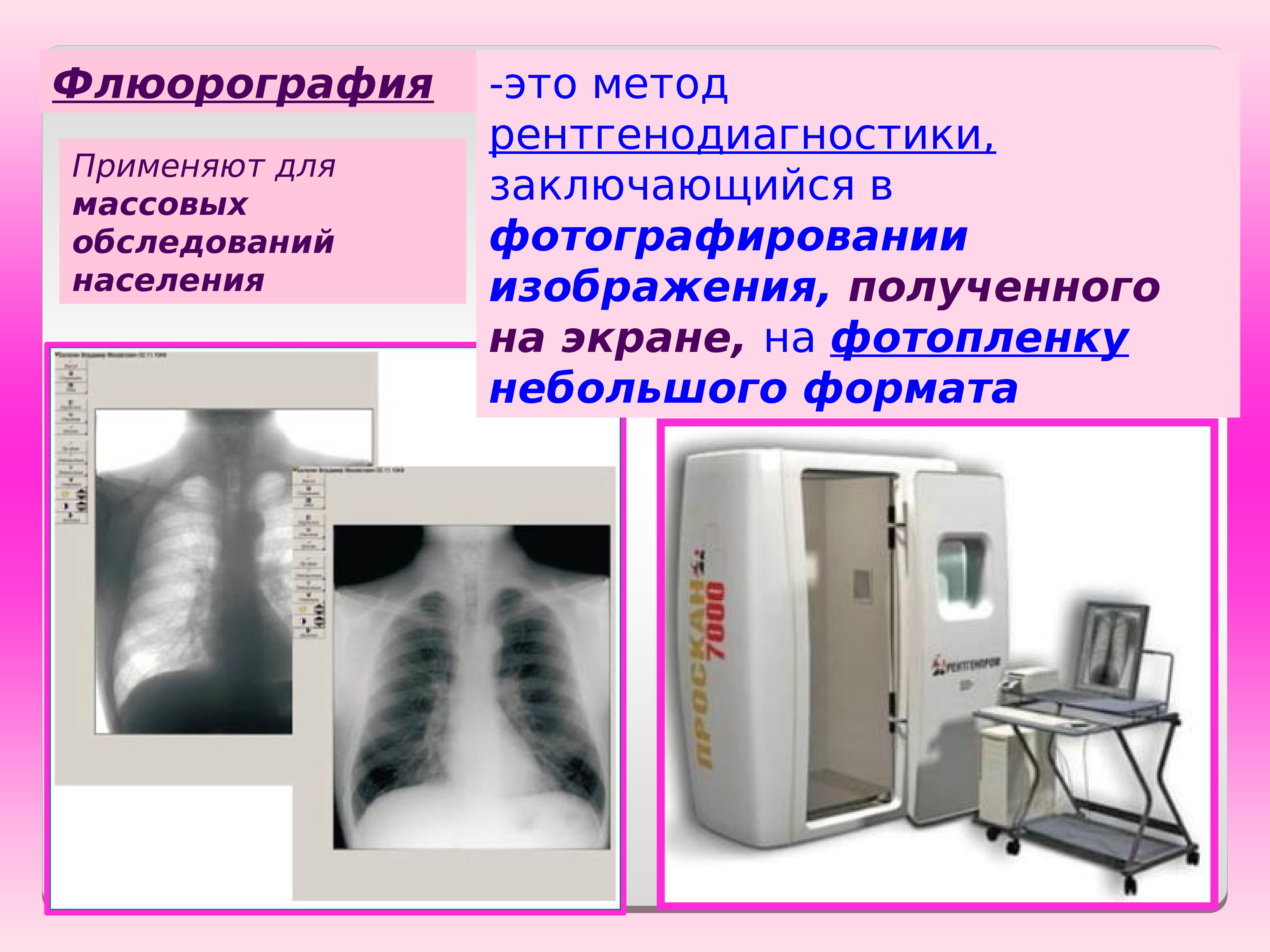 Флюорография для чего она. Флюорография памятка. Флюорографическое исследование органов грудной клетки. Флюорография для чего она. Флюорография плакат.