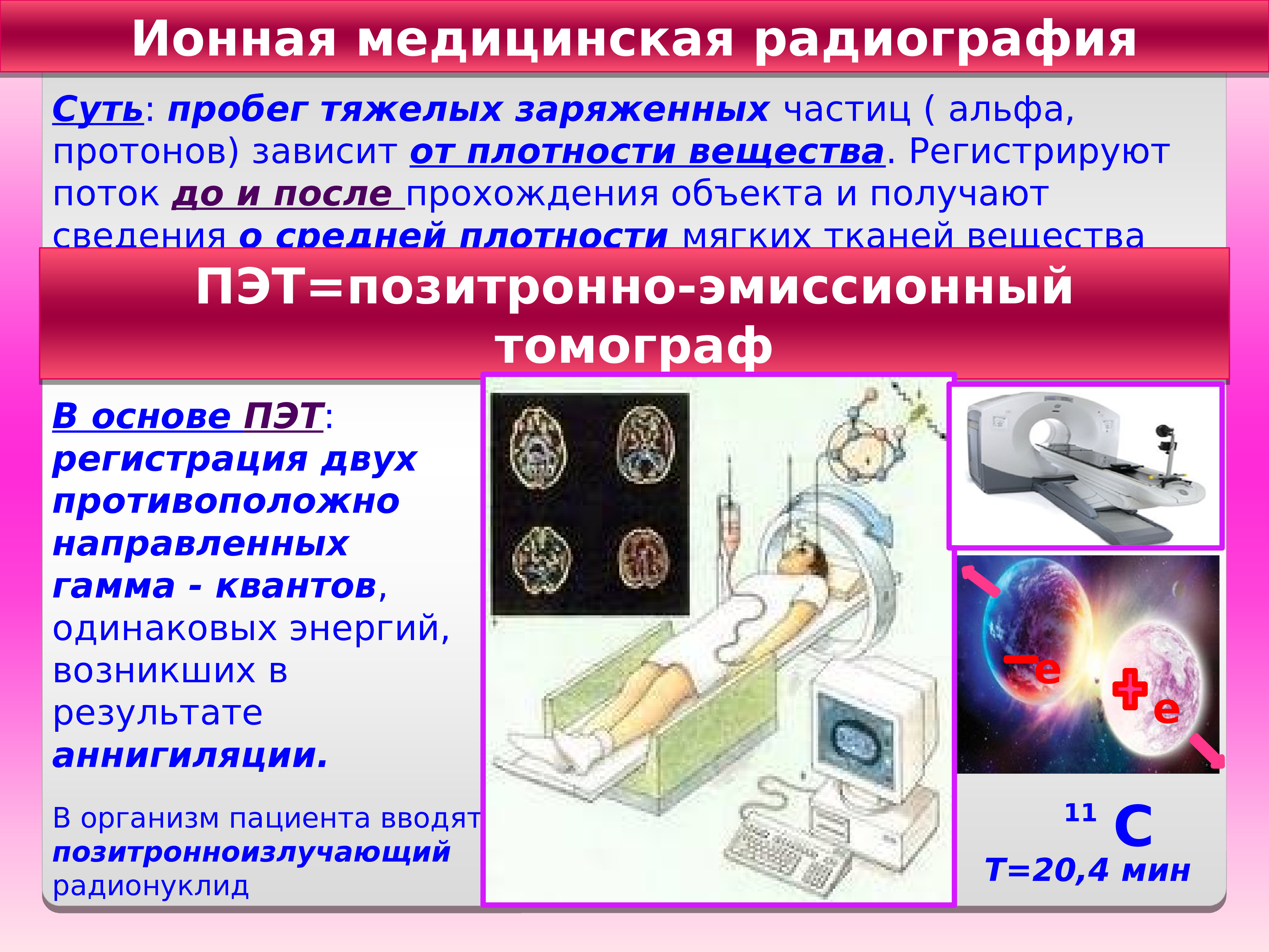 Радиография. Ионная медицинская радиография. Радиография в медицине. Ионное облучение. Клиническая радиография.