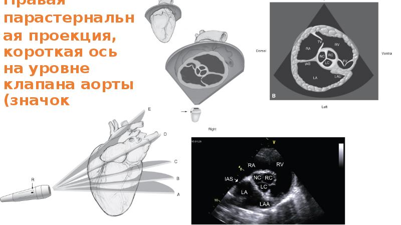 Презентация на тему узи сердца