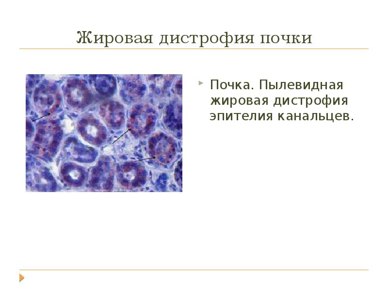 Презентация на тему дистрофия