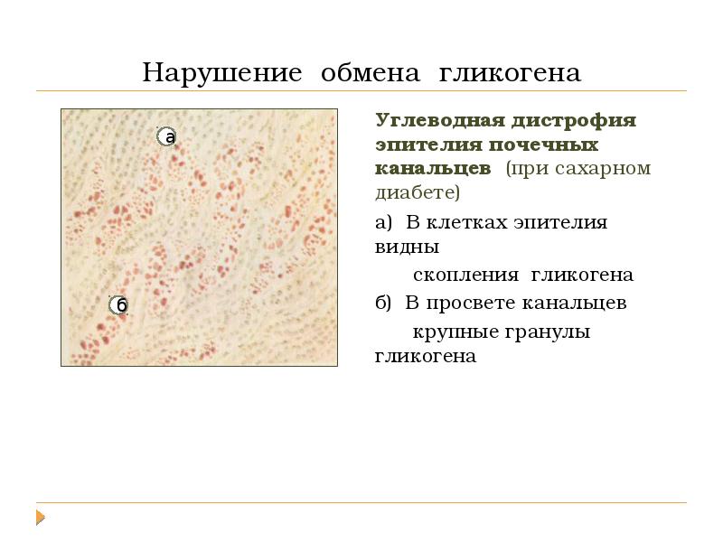 Повреждения дистрофии презентация